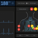 GE HealthCare EKG User Interface Dark Mode